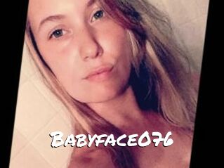 Babyface076