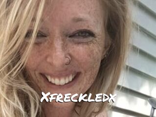 Xfreckledx